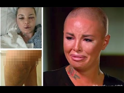 Christy Mack was almost killed by a-hole War Machine